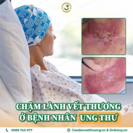 Chậm lành vết thương ở bệnh nhân ung thư