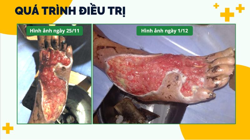 chăm sóc da sau bão