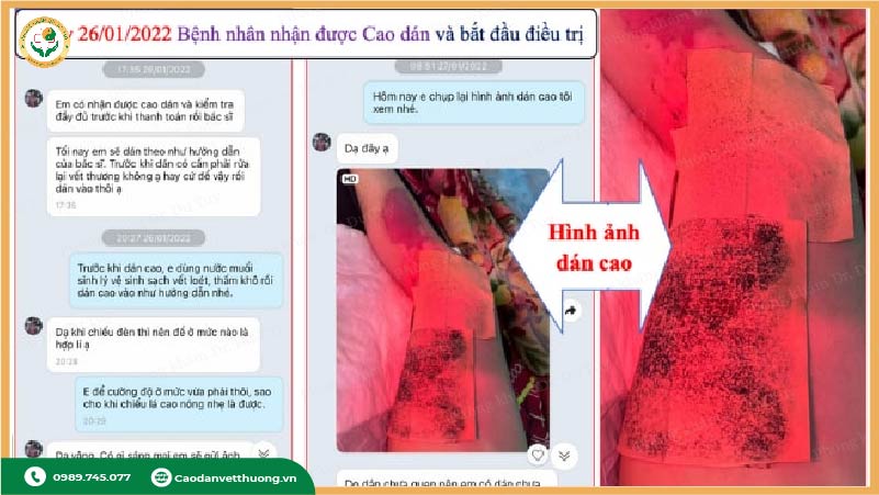 cham-soc-vet-bong-dung-cach