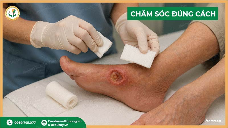 cham-soc-vet-loet-dung-cach(1)