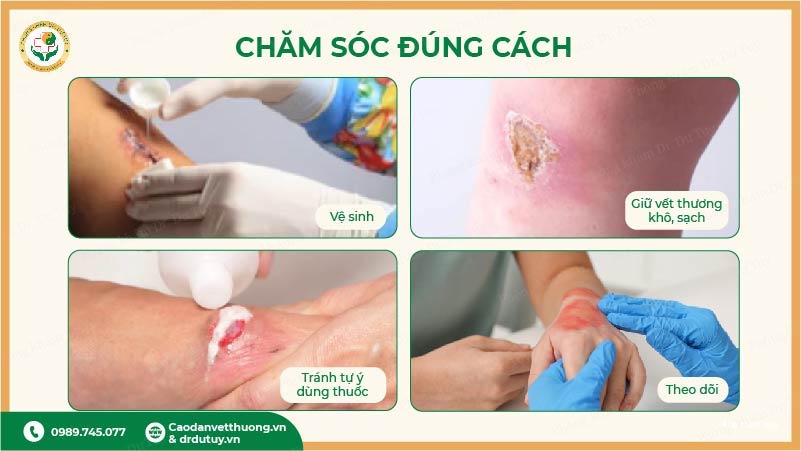 cham-soc-vet-thuong-dung-cach(1)