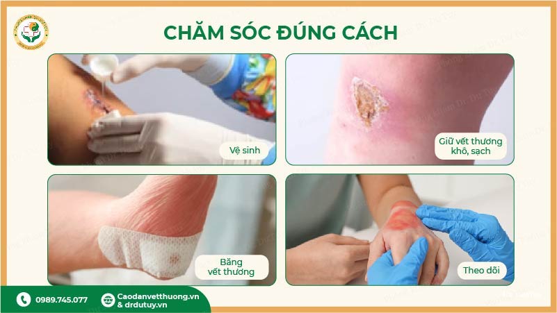 cham-soc-vet-thuong-dung-cach