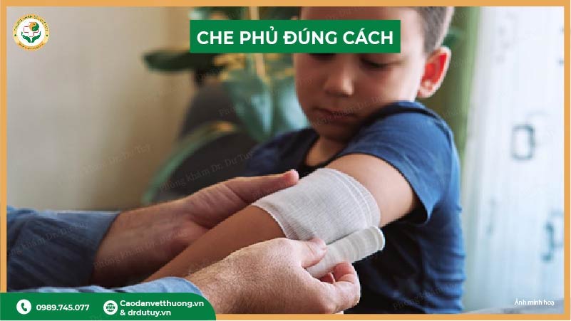 che phủ vết bỏng bằng gạc