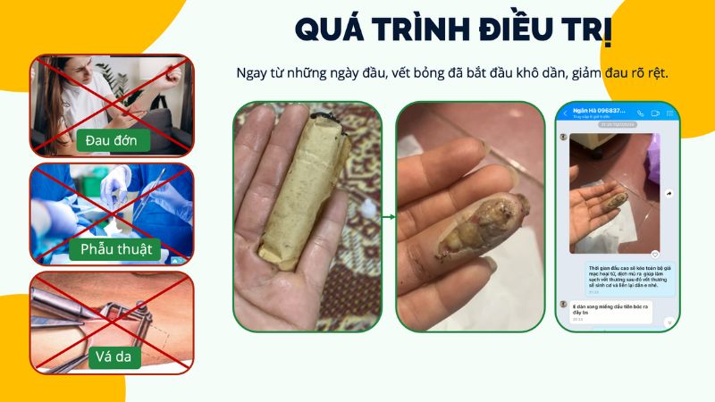 chua-bong-dien-tai-nha