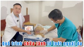 Chữa lành lở loét da cho người bệnh nằm liệt lâu ngày tại Hà Nội