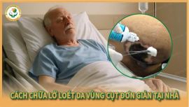 Cách chữa lở loét da vùng cụt đơn giản tại nhà