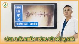 Hành Trình Chữa Nhiễm Trùng Vết Mổ Ruột Thừa Bằng Cao Dán Đông Y Dr. Dư Tuy