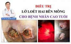 Chuyên điều trị các vết lở loét mất da tại Hà Nam