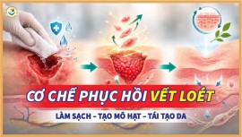Tìm hiểu quy trình: Làm sạch - Tạo mô hạt - Tái tạo biểu bì trong điều trị loét