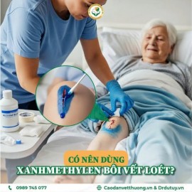 Có nên dùng xanh Methylen bôi vết loét không?