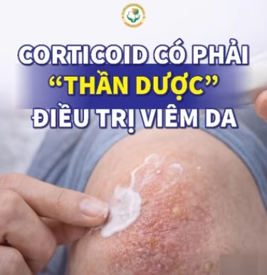 corticoid-co-phai-than-duoc-trong-dieu-tri-viem