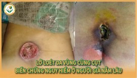 Cụ bà 83 tuổi và hành trình chiến thắng vết loét vùng cùng cụt