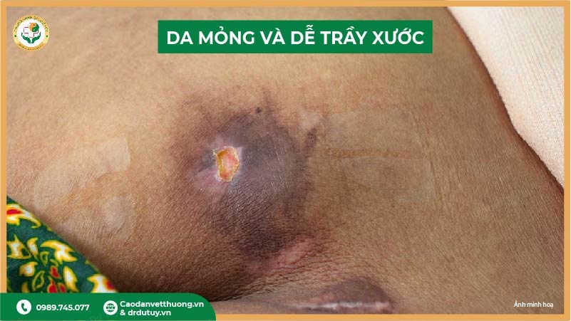 da-mong-va-de-tray-xuoc-o-vung-cung-cut