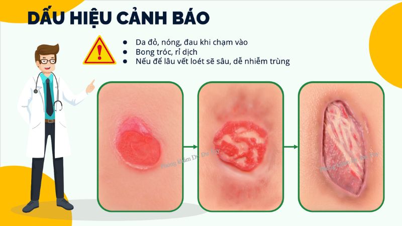 dau-hieu-loet-da-nguoi-gia(1)