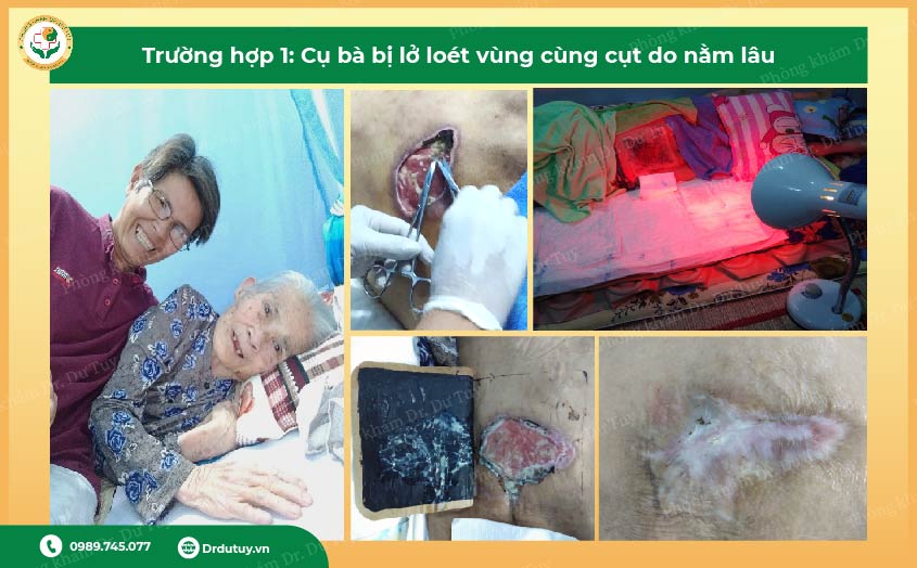 dau-hieu-nhan-biet-lo-loet-ngoai-da-som-nhat-dung-cho-den-khi-qua-muon3