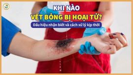 Dấu hiệu vết bỏng bị hoại tử: Làm sao để nhận biết sớm?