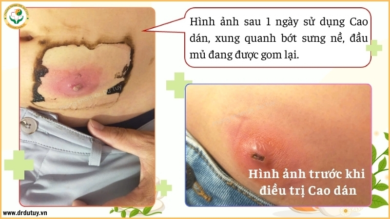 dien-bien-o-ap-xe-sau-1-ngay-dan-cao
