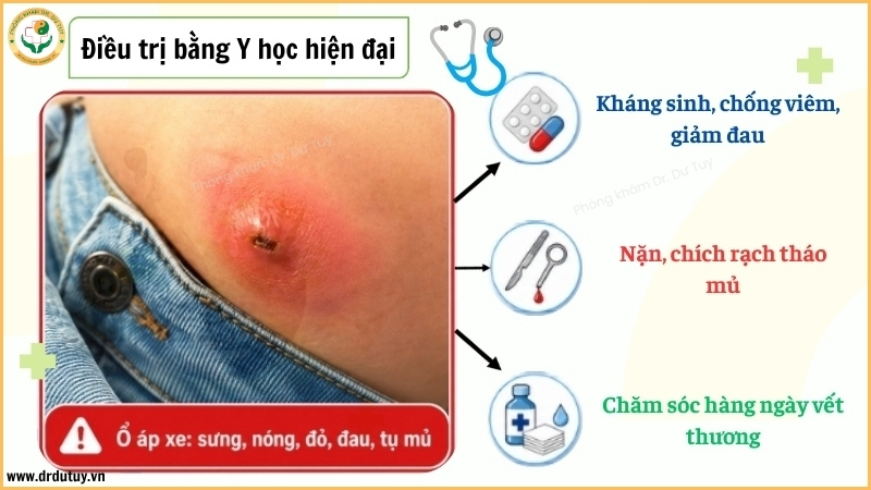 dieu-tri-ap-xe-theo-y-hoc-hien-dai
