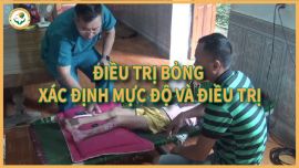 Cách điều trị vết bỏng tại nhà nhanh lành, không để lại sẹo