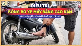 Điều trị bỏng bô xe máy bằng cao dán: Giải pháp giúp nhanh lành và hạn chế sẹo