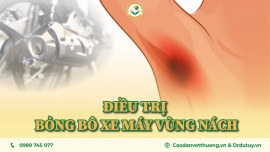 ĐIỀU TRỊ BỎNG TẠI NHÀ - LÀNH VẾT BỎNG BÔ XE MÁY VÙNG NÁCH NHỜ CAO DÁN GIA TRUYỀN