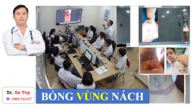 Điều trị vết bỏng gây lở loét da bằng cao dán Đông y tại Bắc Ninh