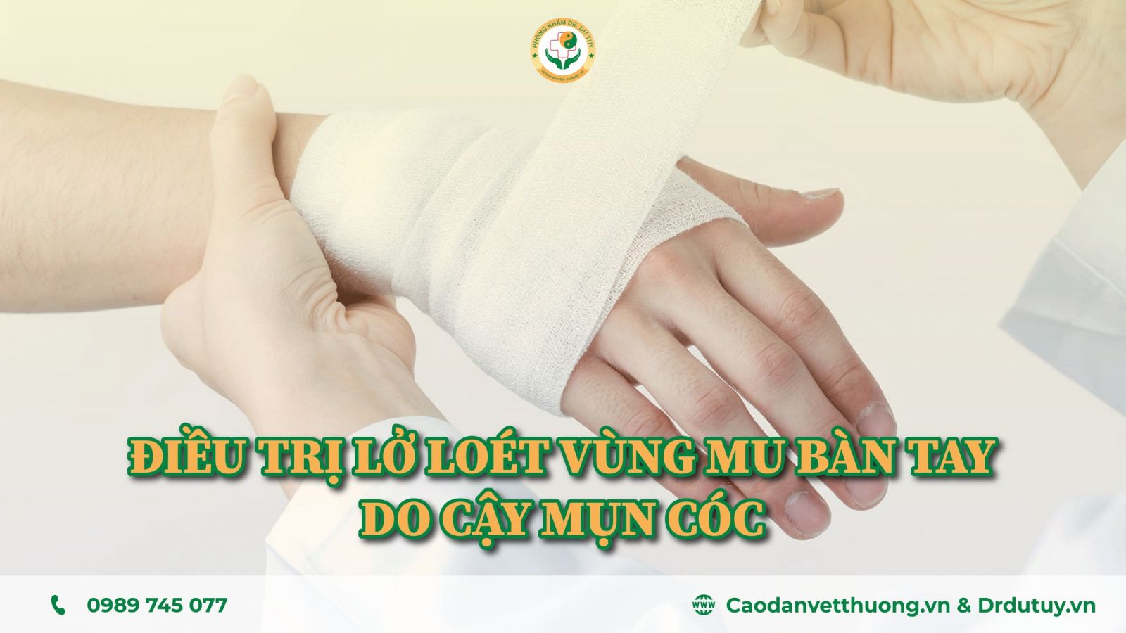 dieu-tri-cho-benh-nhan-co-vet-loet-o-mu-ban-tay-do-cay-mun-coc