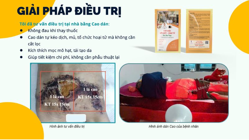 dieu-tri-hoai-tu-sau-phau-thuat