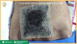 Điều trị lở loét, hoại tử diện rộng: Ưu thế vượt trội từ cao dán thảo dược
