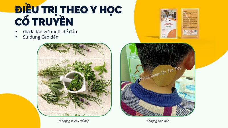 dieu-tri-mun-nhot-cho-be