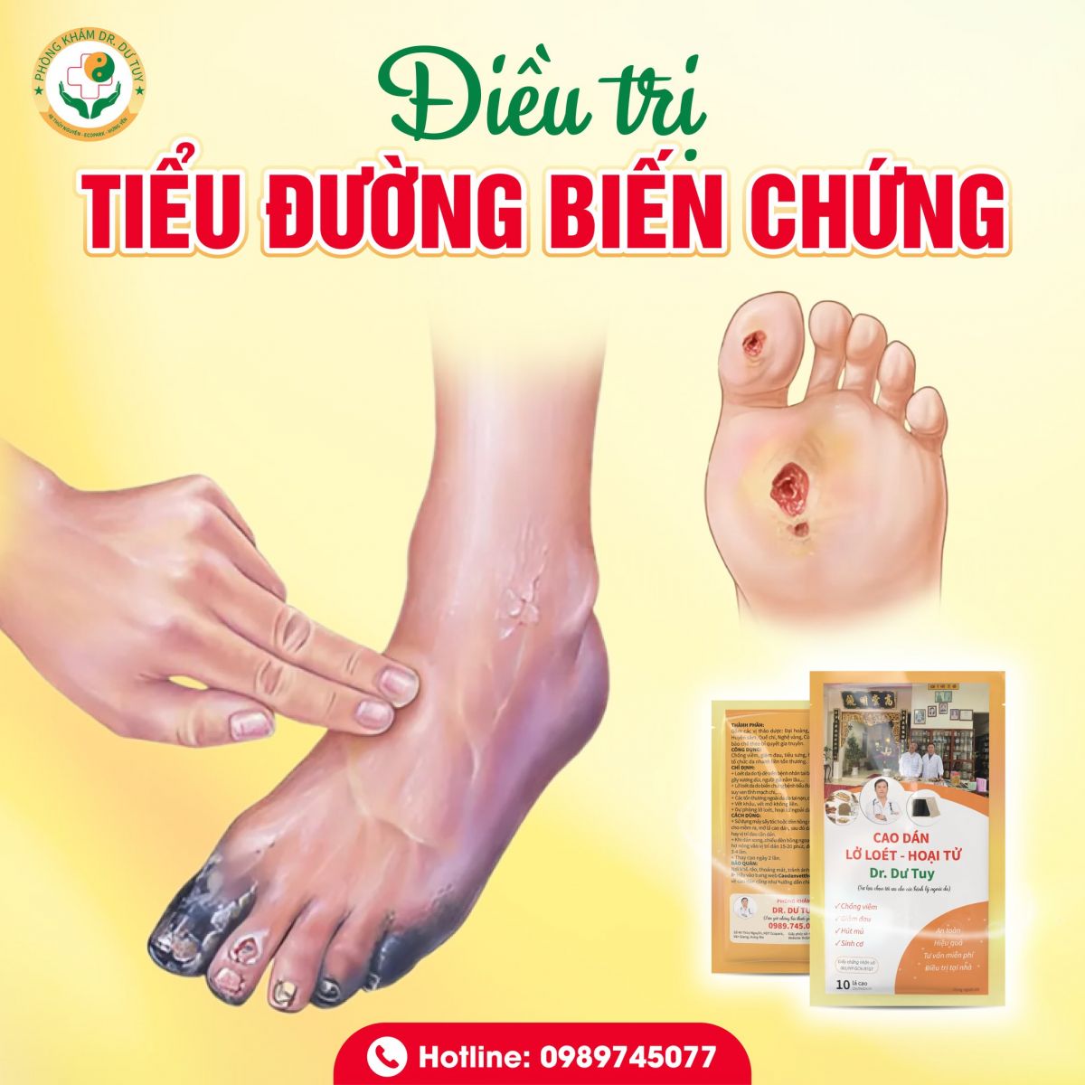 dieu-tri-tieu-duong-bien-chung-gay-loet-da