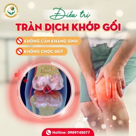 ĐIỀU TRỊ TRÀN DỊCH KHỚP GỐI HIỆU QUẢ BẰNG ĐÔNG Y – KHÔNG KHÁNG SINH, KHÔNG CHỌC HÚT