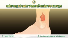 ĐIỀU TRỊ VẾT LỞ LOÉT VÙNG CỔ CHÂN CHO BỆNH NHÂN SAU TAI NẠN