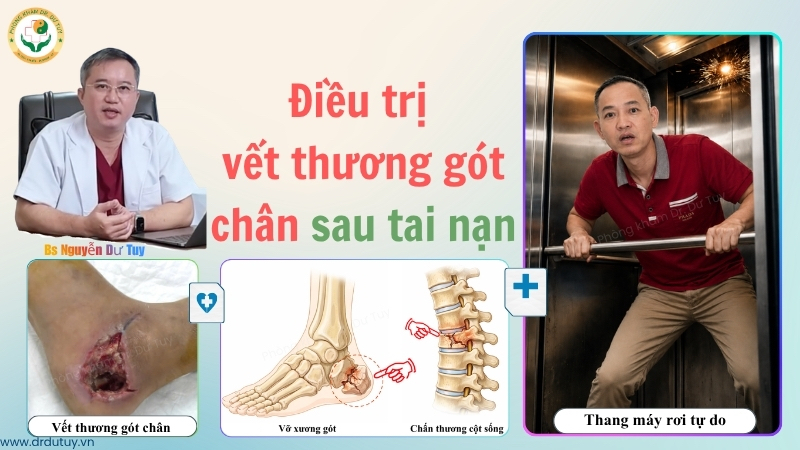 dieu-tri-vet-thuong-got-chan-sau-tai-nan-dr-du-tuy
