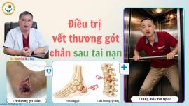 Chữa Lành Vết Thương Gót Chân Cho Bệnh Nhân Tiểu Đường Bị Liệt Do Tai Nạn