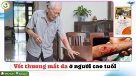 Vết thương mất da ở người cao tuổi: Tại sao không nên chủ quan và cách xử trí an toàn
