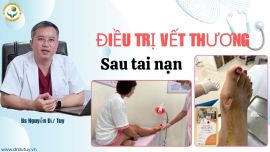 Xử Lý Vết Thương Mất Da Sau Tai Nạn Xe Máy: Đừng Chủ Quan Để Rồi Bục Chỉ, Loét Sâu