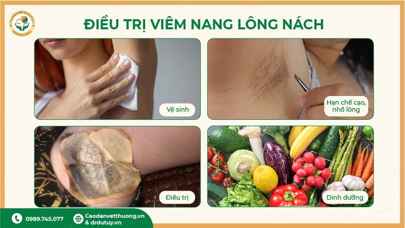dieu-tri-viem-nang-long-nach
