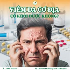 GIẢI ĐÁP THẮC MẮC: VIÊM DA CƠ ĐỊA CÓ KHỎI ĐƯỢC KHÔNG?