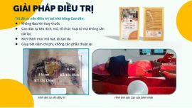 Giải Pháp Điều Trị Hoại Tử Hiệu Quả Từ Bs Tuy Cho Ca Kéo Vạt Da Bị Thất Bại