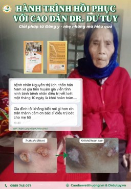 Hành trình hồi phục loét da nhờ Cao dán Dr Dư Tuy