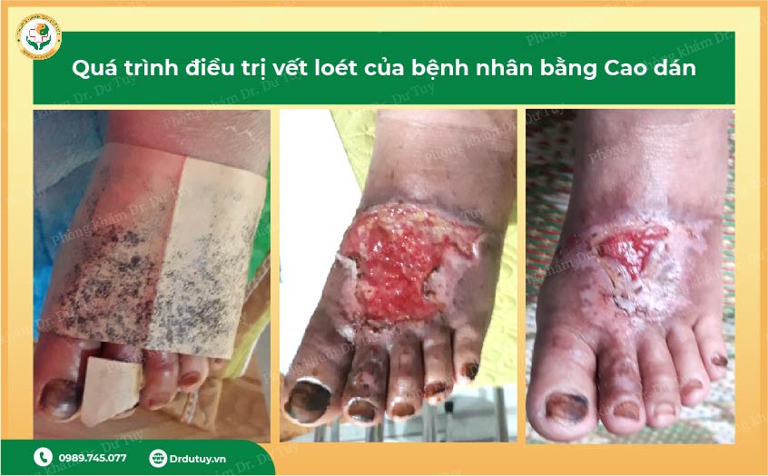 hanh-trinh-thoat-hoai-tu-chan-than-ky-cua-co-giao-vung-cao-sau-30-ngay-anh3
