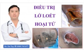 Hết hôi thối, nhanh lành vết loét tì đè nhờ Cao dán Đông y 