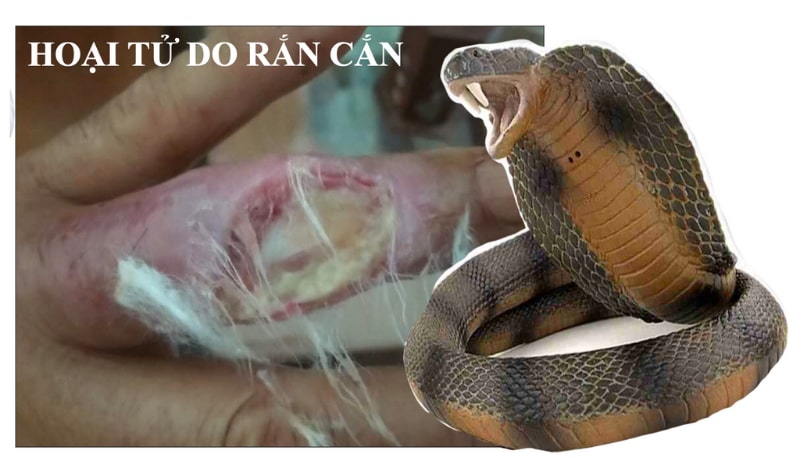 Hình ảnh vết cắn của rắn độc