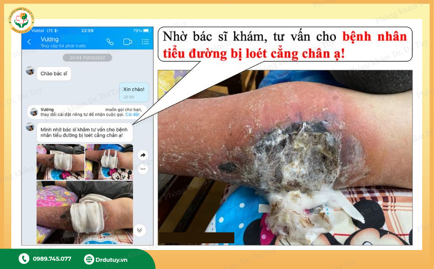 hoai-tu-chan-co-chua-khoi-duoc-khong2