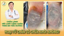 Hoại tử chân có chữa khỏi được không?