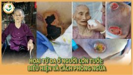 Làm Gì Khi Phát Hiện Da Bị Hoại Tử? 