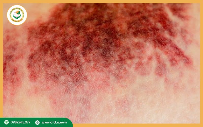 hoai-tu-kho-va-hoai-tu-uot-2(1)