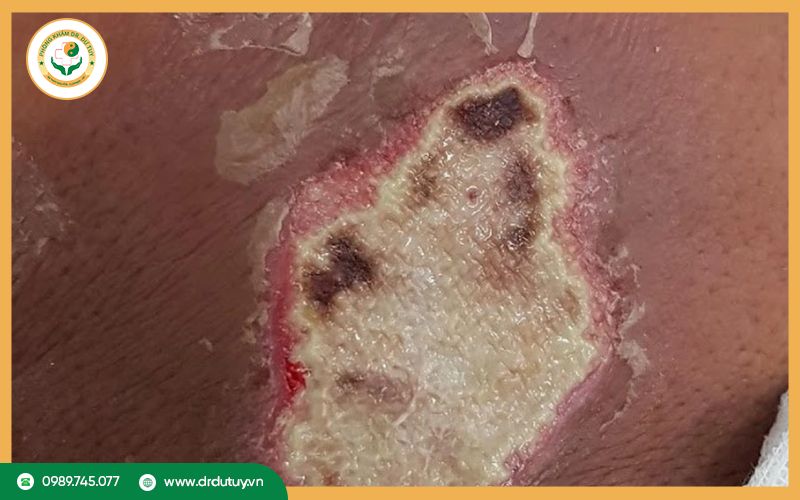 hoai-tu-kho-va-hoai-tu-uot-4