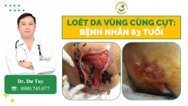 Chủ quan vết thương nhỏ: Hậu quả hoại tử nặng ở người già